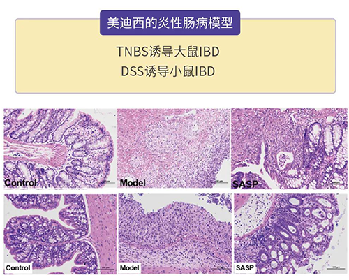 凯时首页的炎症性肠病模型