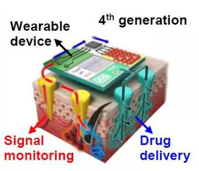 第四代透皮给药技术：在可穿戴设备的帮助下，用于患者定制治疗.jpg